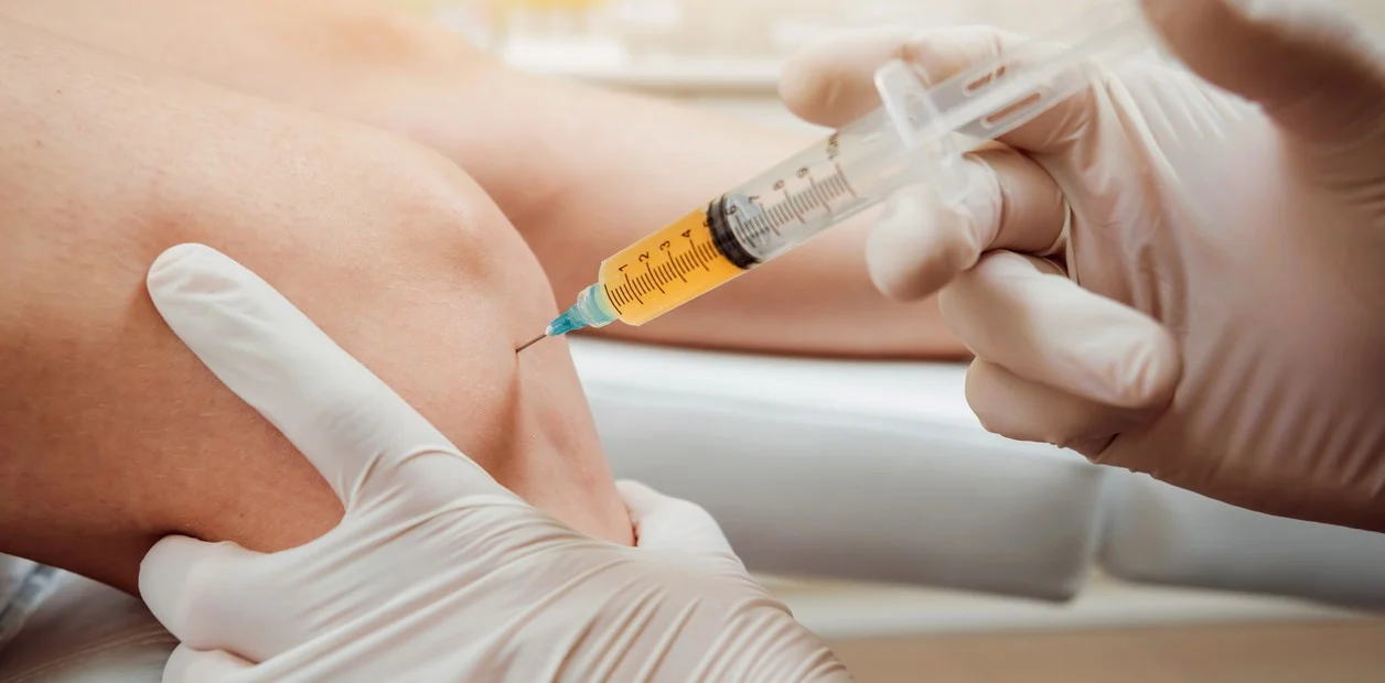 Plasma Rico en Plaquetas, un tratamiento seguro y eficaz en la Artrosis de Rodilla